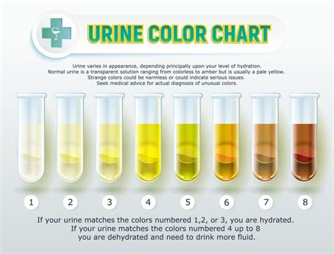 will 2 bottles of water dilute a drug test|diluted drug test water levels.